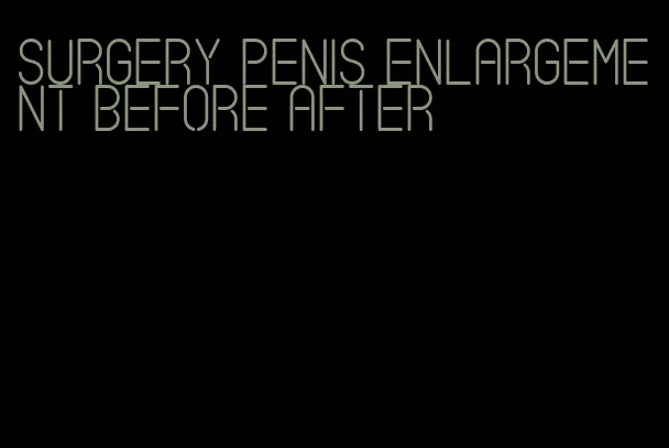 surgery penis enlargement before after